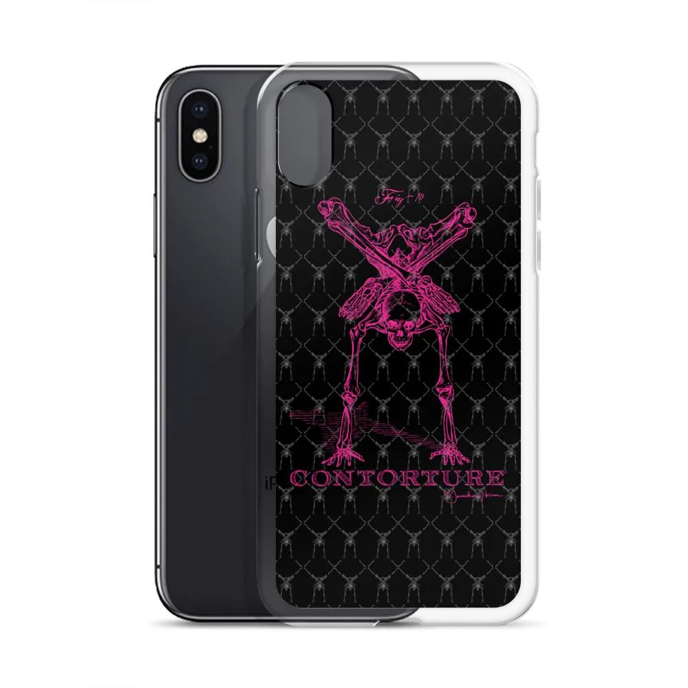 Contorture iPhone Case: Pinky Contortion Skeleton