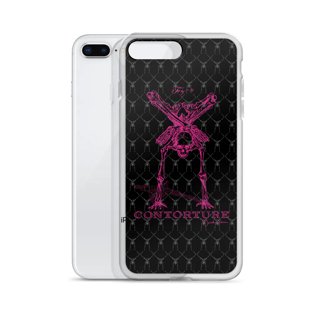 Contorture iPhone Case: Pinky Contortion Skeleton