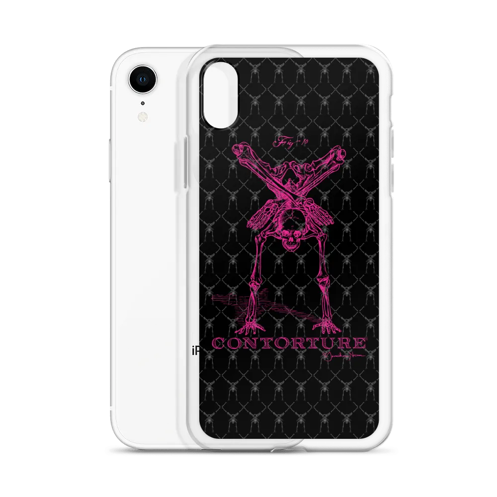 Contorture iPhone Case: Pinky Contortion Skeleton