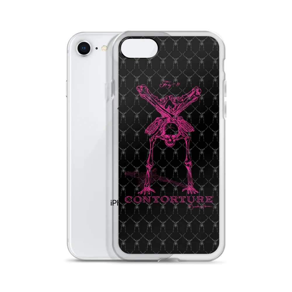 Contorture iPhone Case: Pinky Contortion Skeleton