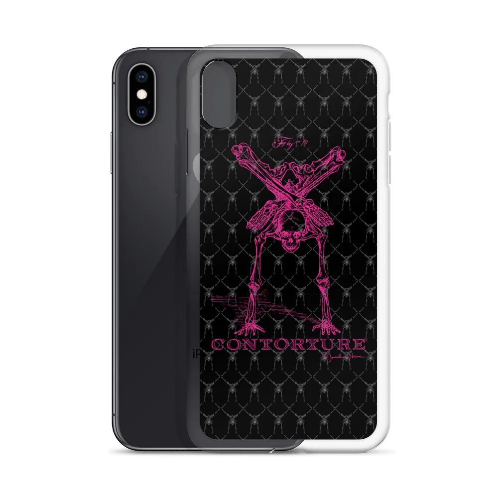 Contorture iPhone Case: Pinky Contortion Skeleton