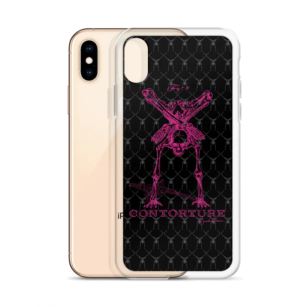 Contorture iPhone Case: Pinky Contortion Skeleton