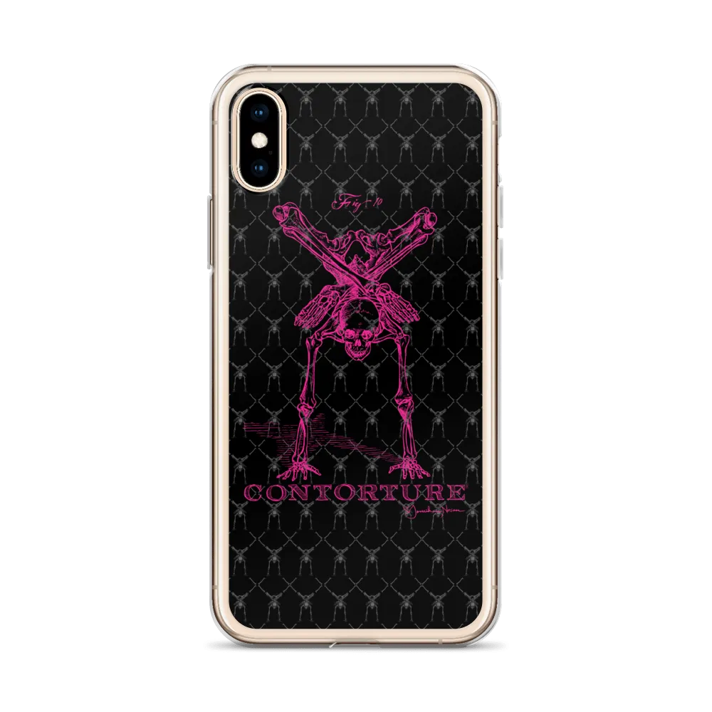 Contorture iPhone Case: Pinky Contortion Skeleton