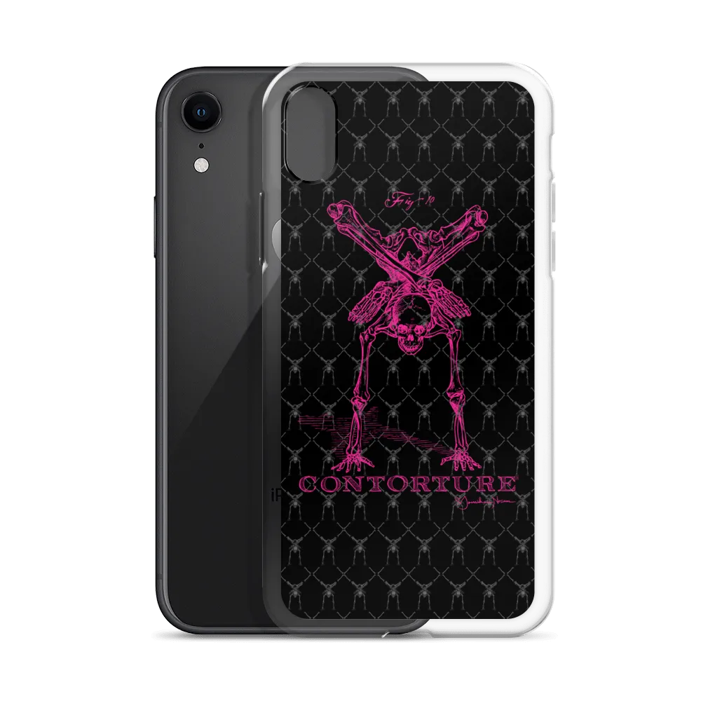 Contorture iPhone Case: Pinky Contortion Skeleton