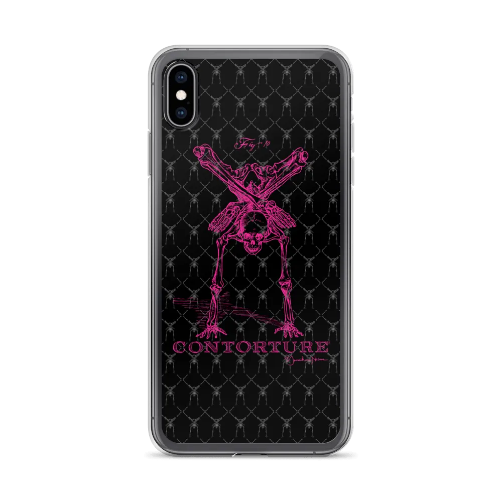 Contorture iPhone Case: Pinky Contortion Skeleton