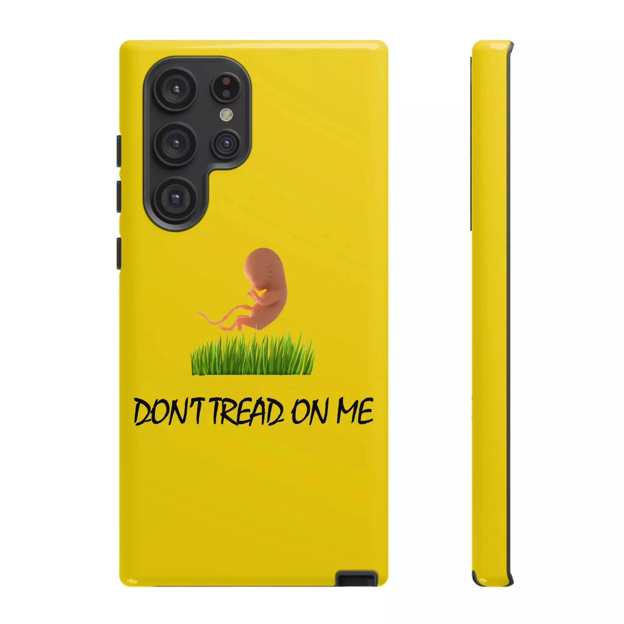 Don't Tread on Baby Phone Case