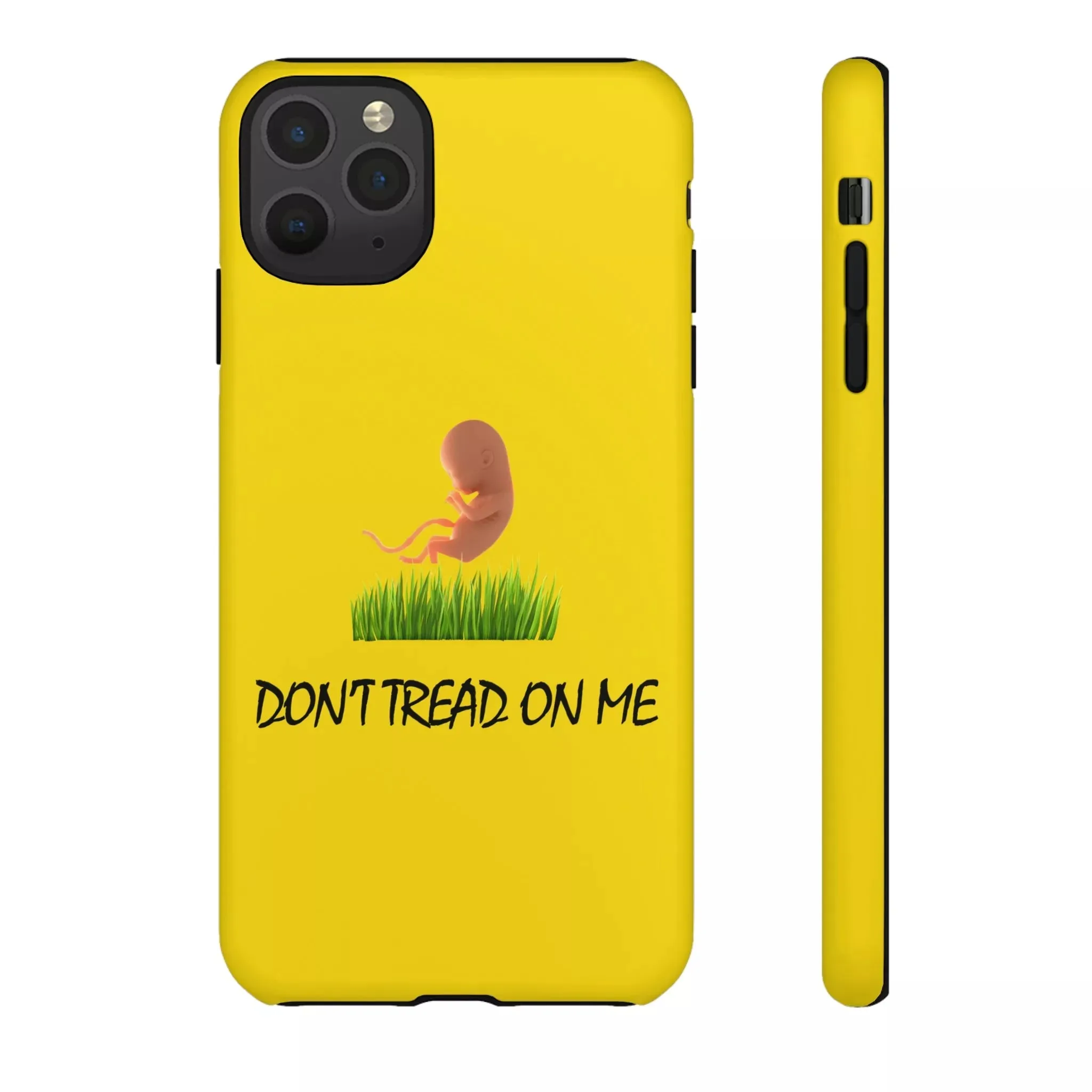 Don't Tread on Baby Phone Case